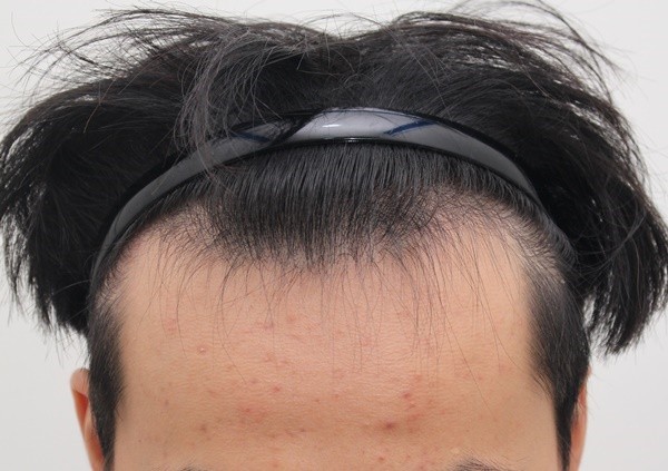 한달째인데 집에서 사진찍어 봤습니다