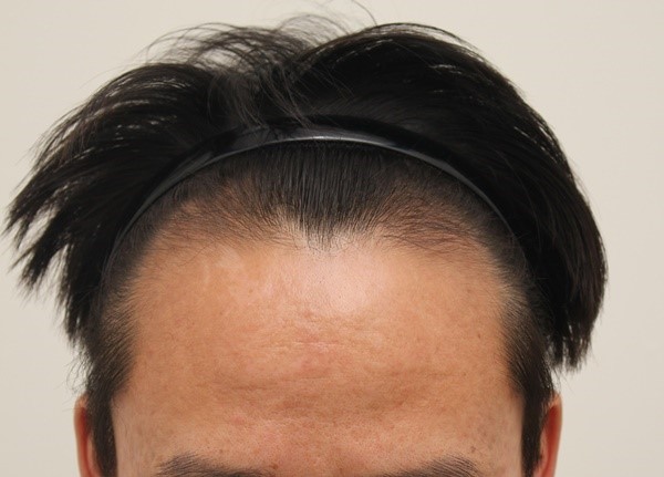 수술전사진.jpg