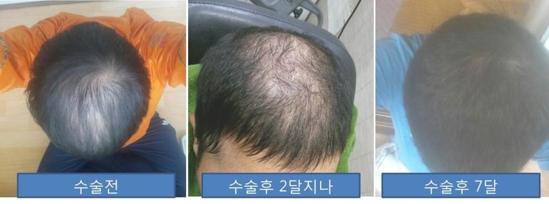 4000모 후기. 암흑기를 까발려보다