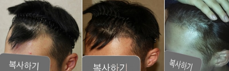 오른쪽 머리.jpg