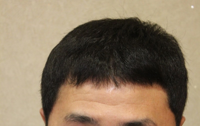 수술후 (1).jpg