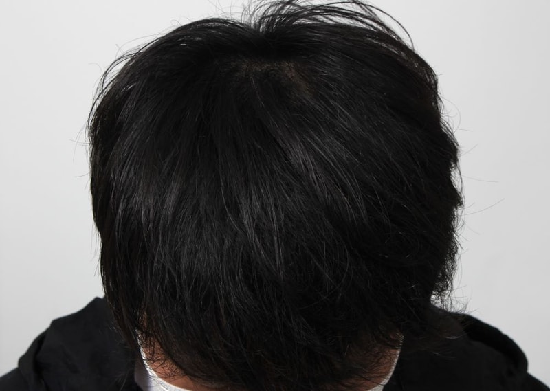 04_수술후.JPG