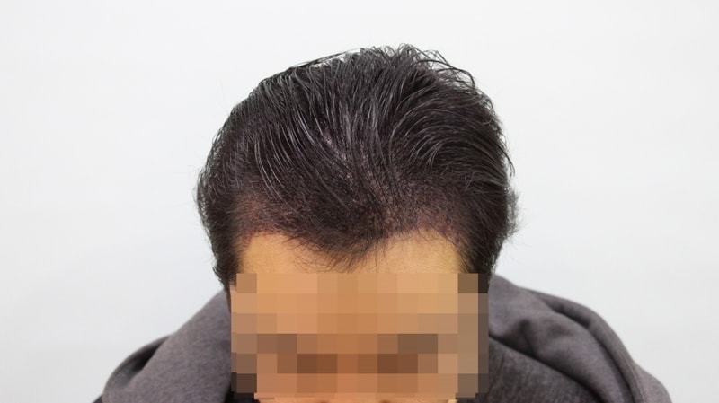 문신후 정면.JPG