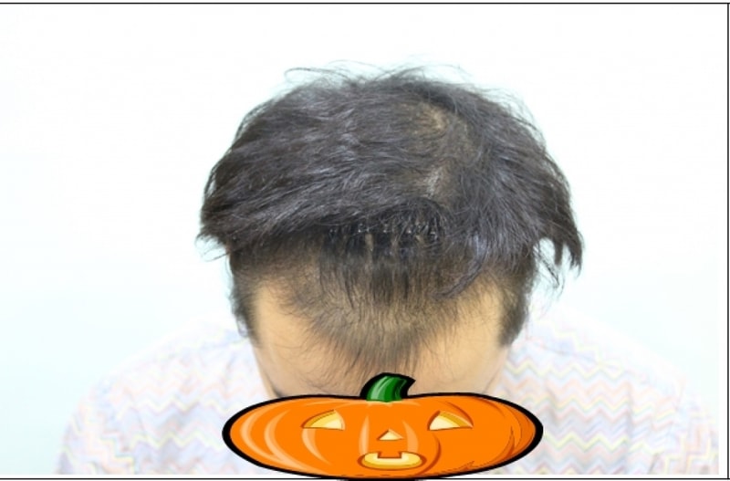 수술전-앞.jpg