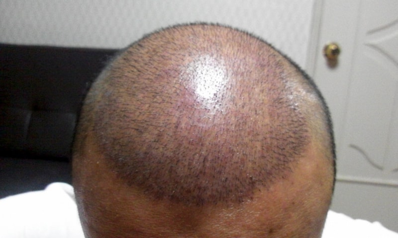 2011-11-22 19.15.54.jpg
