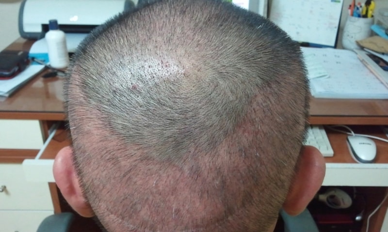 2011-11-26 23.34.36.jpg