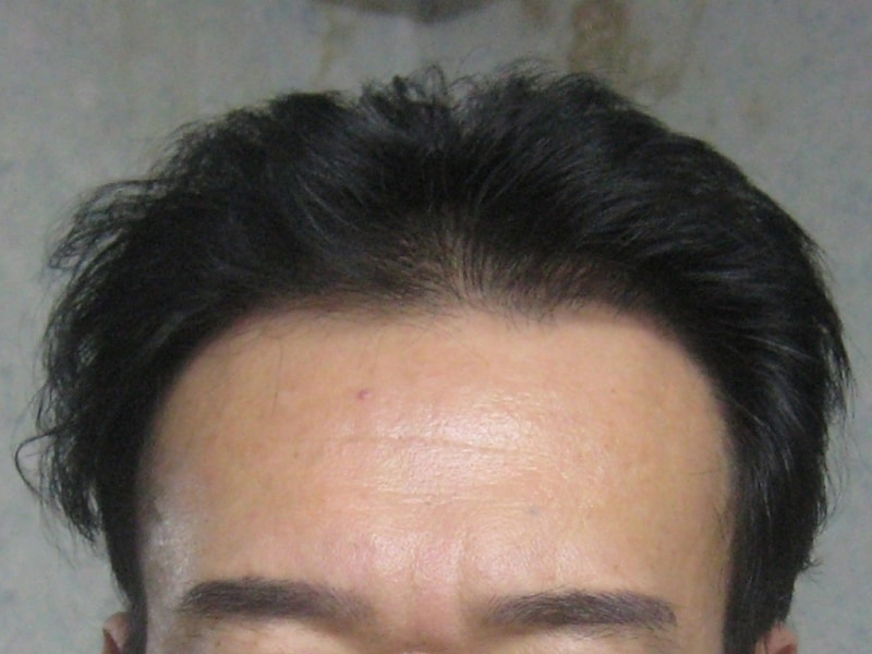 IMG_7830 1년3개월.JPG