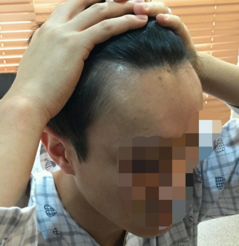 수술전 (11).jpg