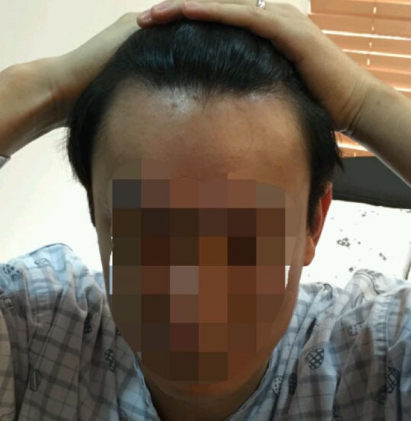 수술전 (22).jpg