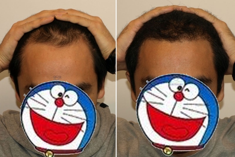 2.PNG