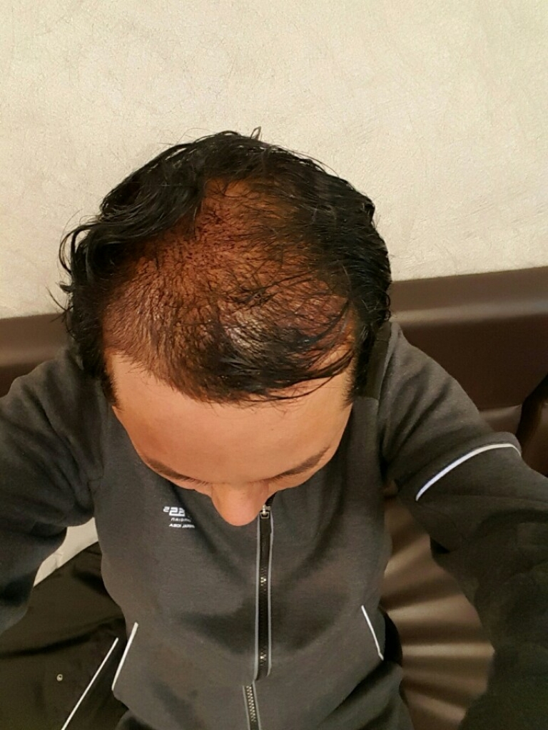 1893474931_iIjvbsYa_KakaoTalk_20170222_150302785.jpg