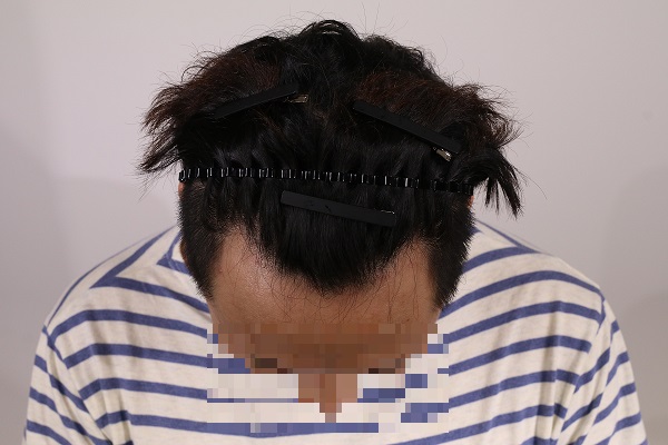 수술전2.jpg