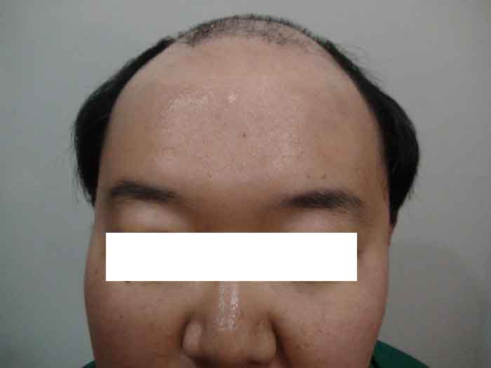 박,전,정,절반,s copy.jpg