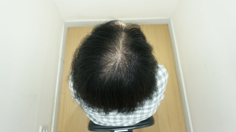 수술 전2.jpg