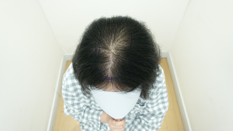 수술 전1.jpg