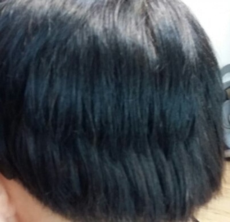 붙임머리후.jpg