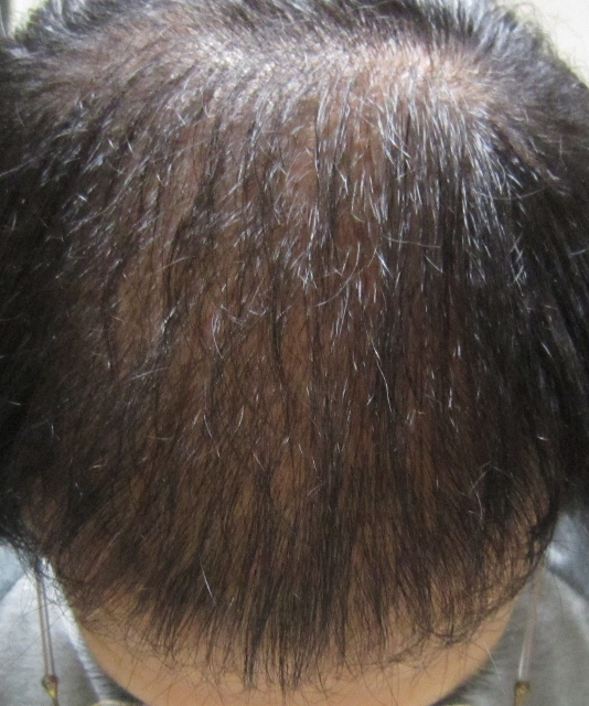 180일차(534x640).jpg