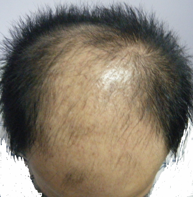 수술전1(626x640).jpg