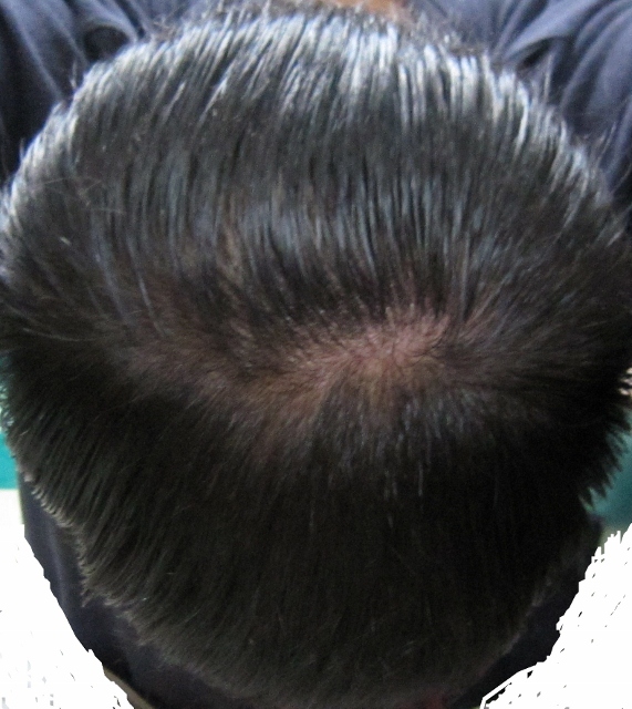 현재사진3(571x640).jpg