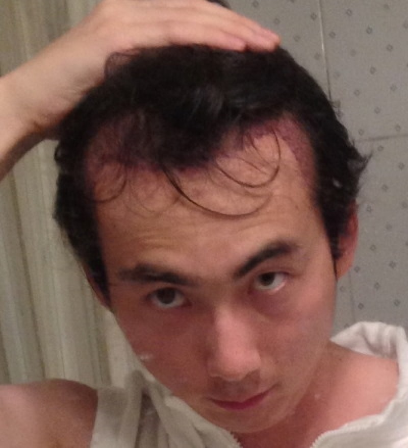 수술다~1.JPG