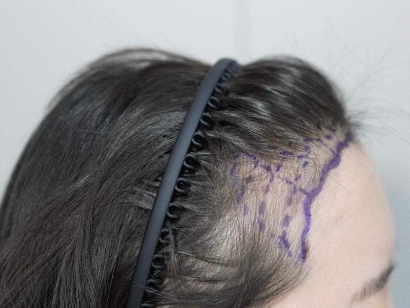 1.jpeg
