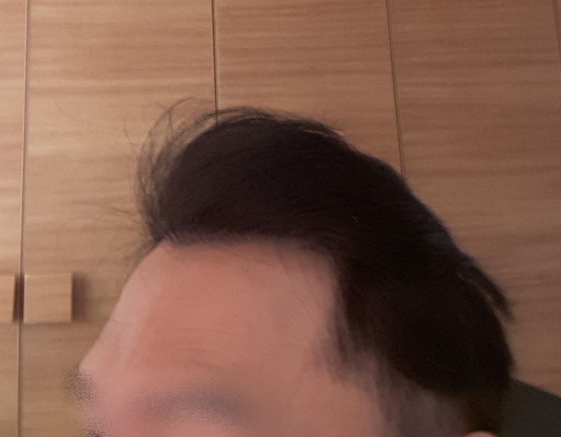 왼.jpg