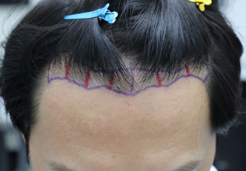 02.밀도보강디자인.JPG