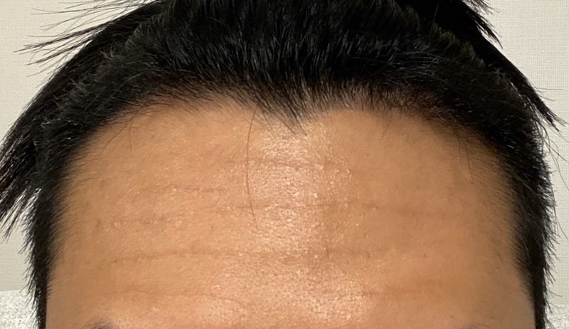다나 5개월 괜찮나요?