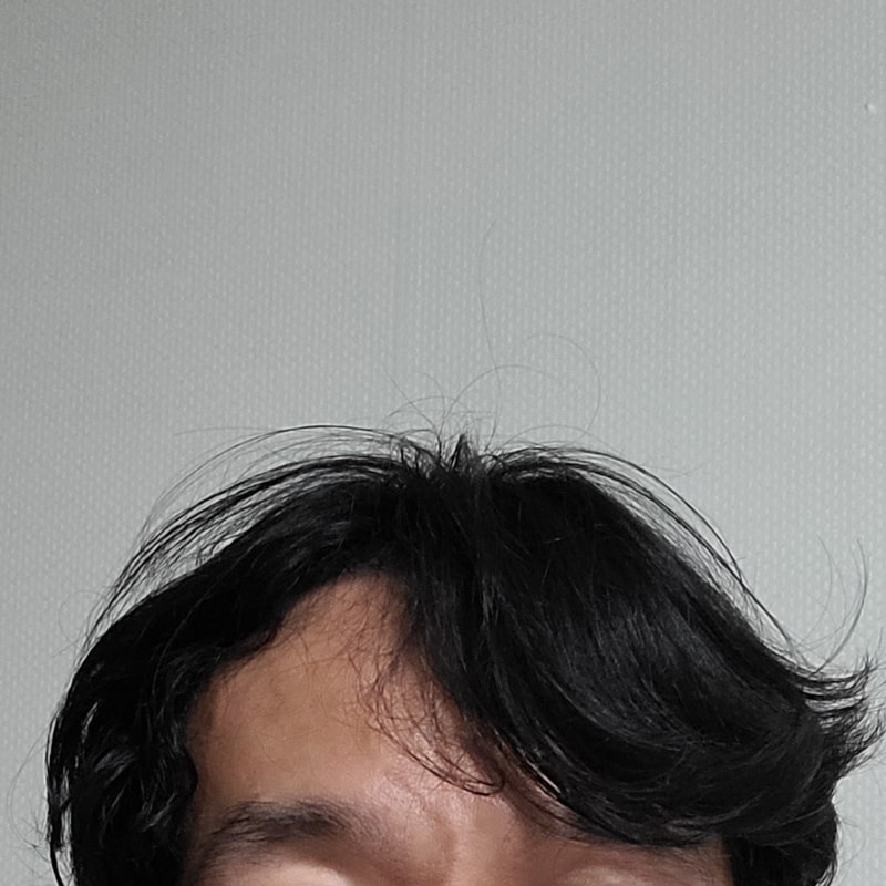 다나 무삭발 12일 경과