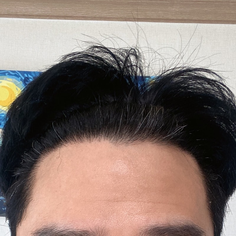 조기졸업:) 다나 7개월 경과