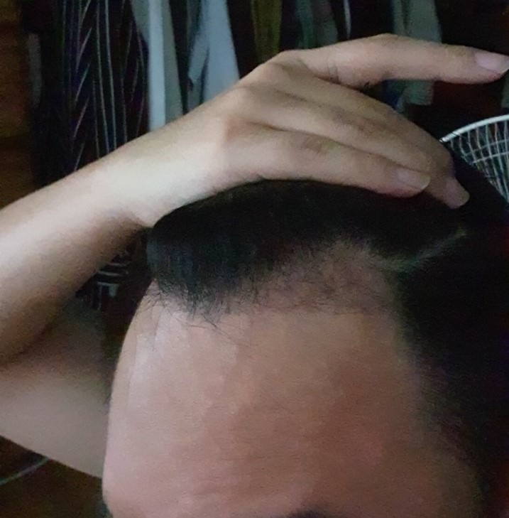 1 1.jpg