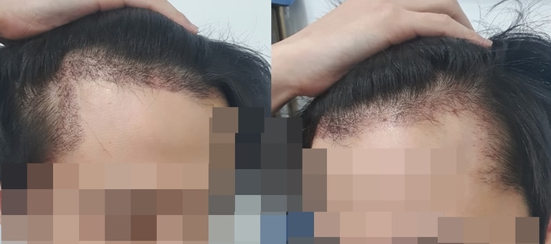 업로드사진 한달 1.jpg