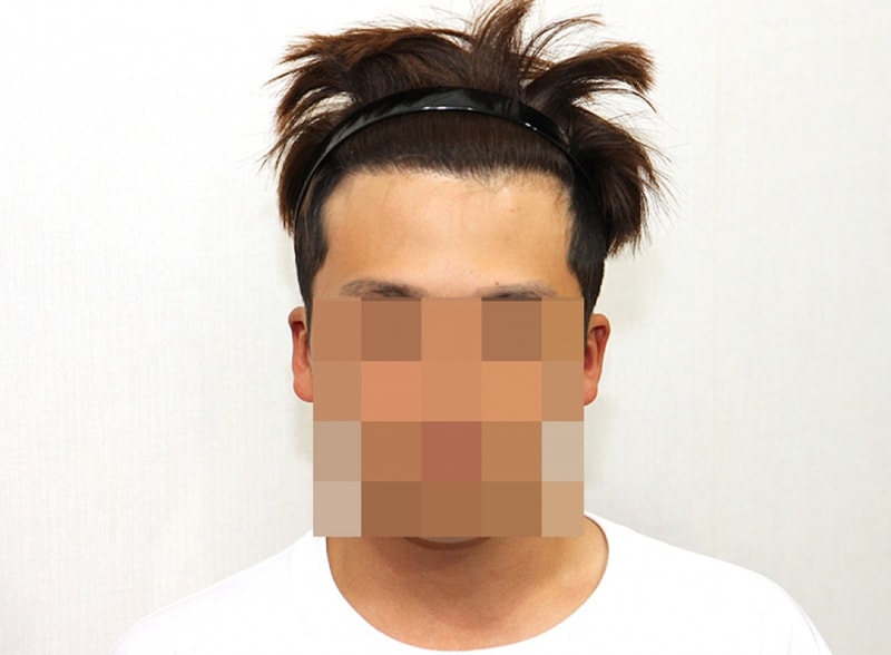 후1.jpg