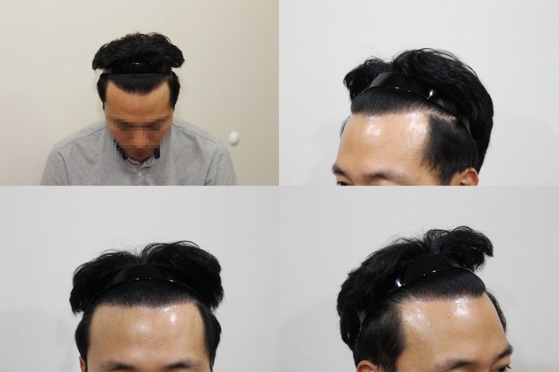 후.png