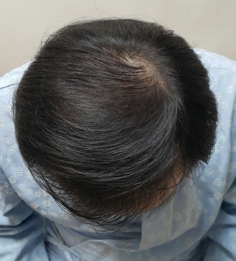 수술전 2.jpg