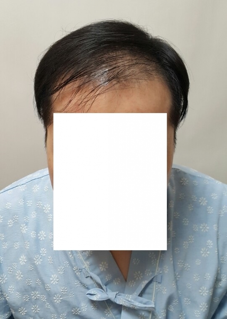 수술전 1.jpg