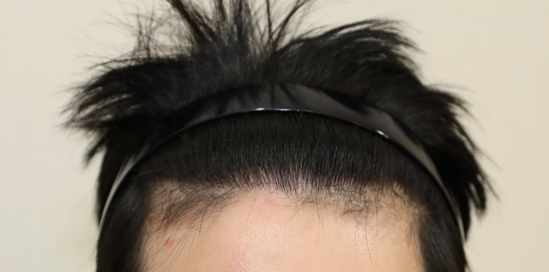 후3.png