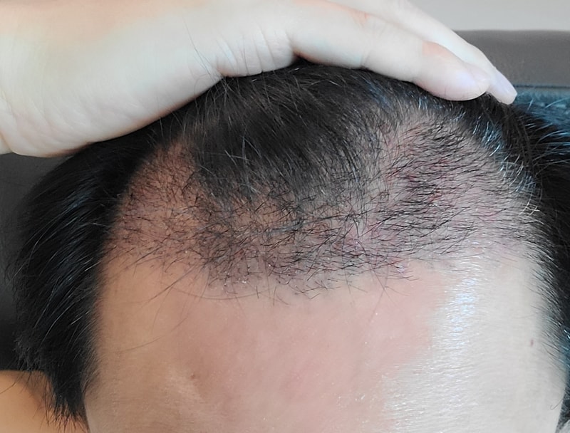 18일 경과.jpg