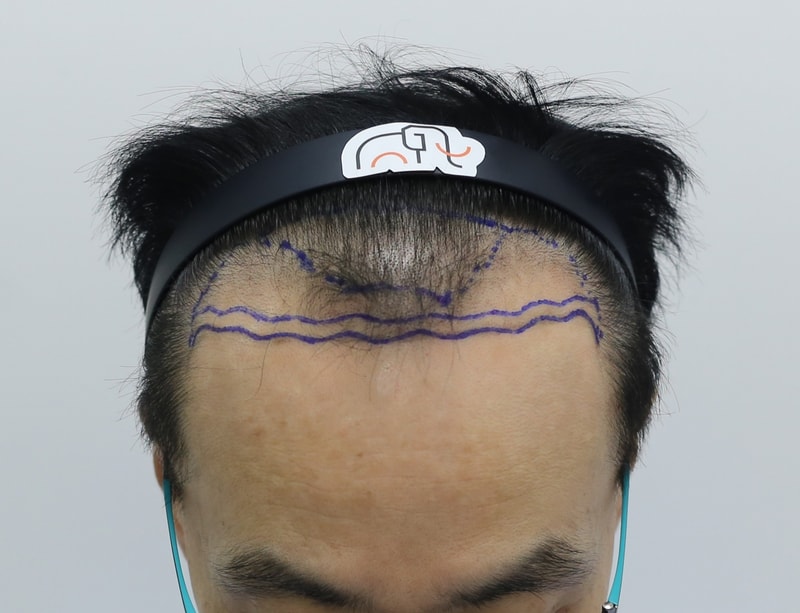 1000003753.jpg