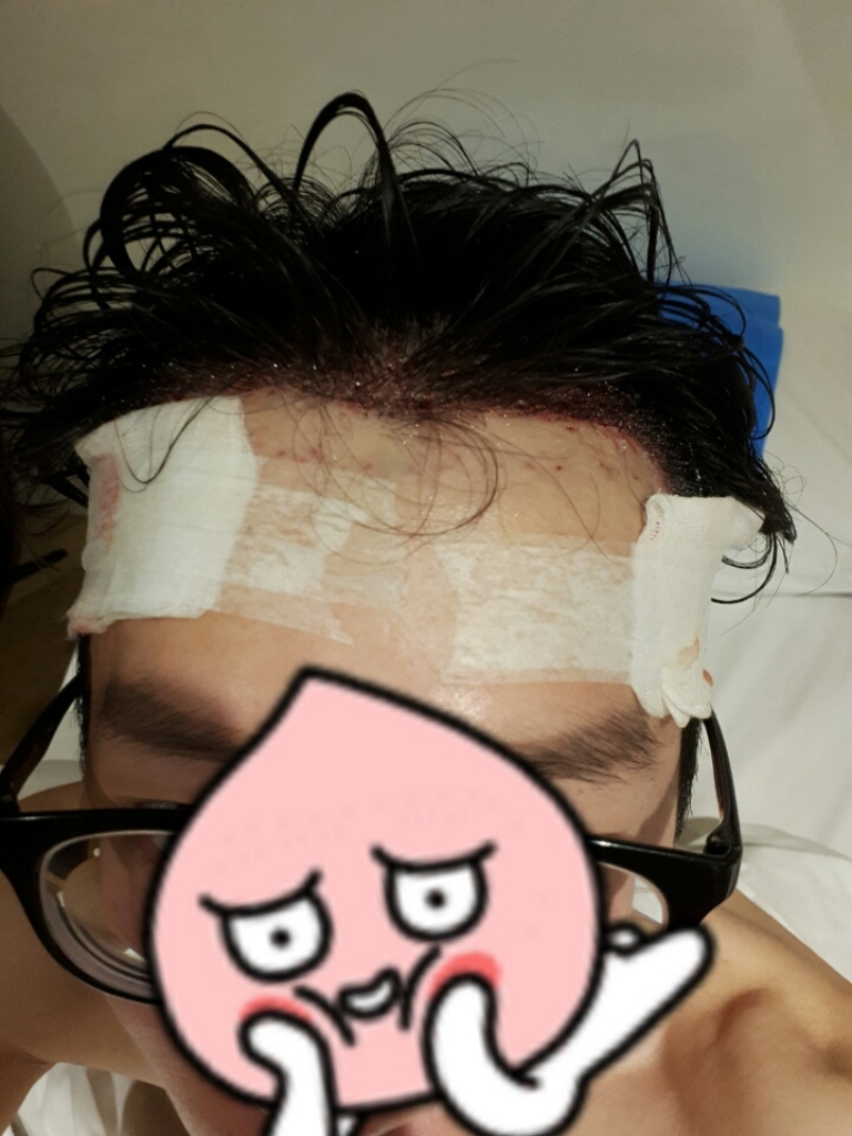 수술 후 숙소에서.jpg