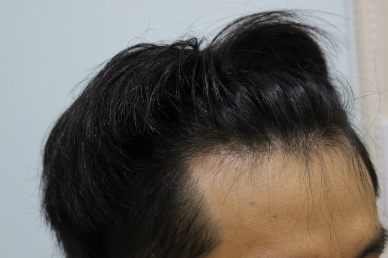 수술전 (6).JPG