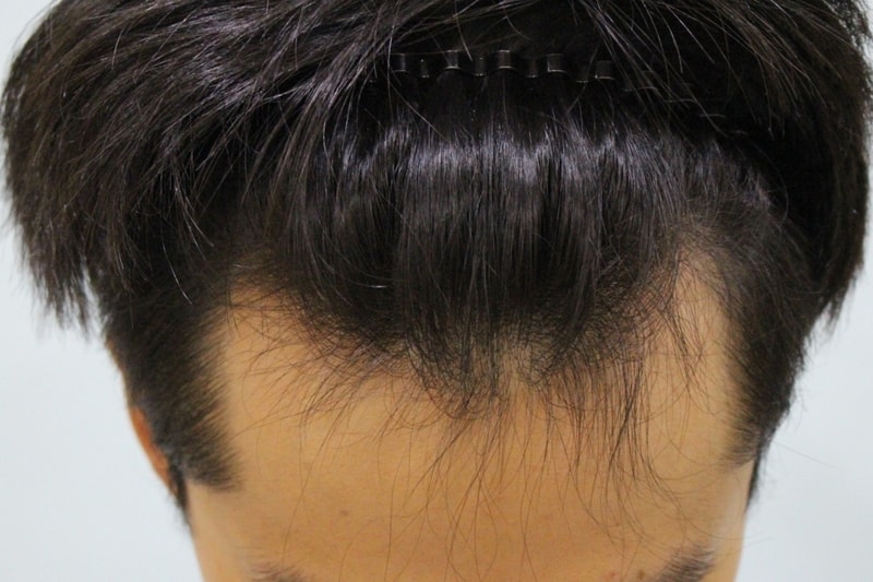 수술전 (1).JPG