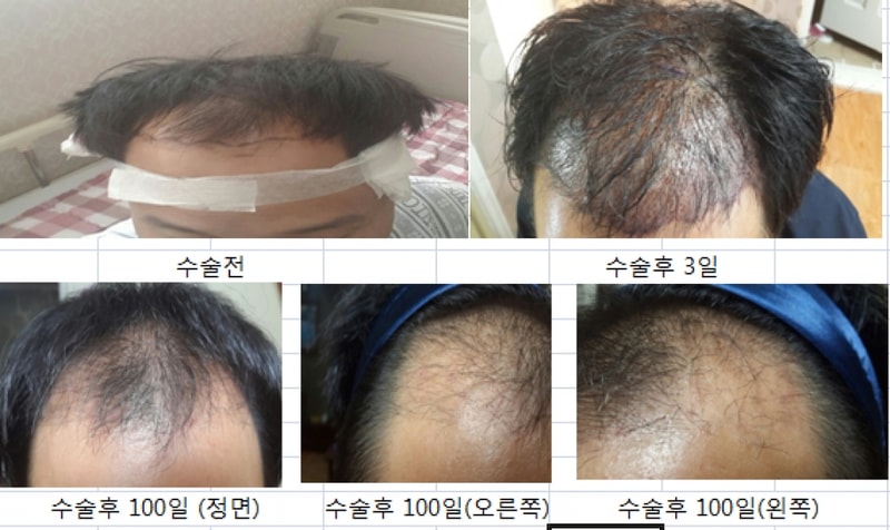 제목 없음.png
