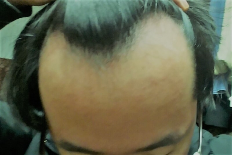 [후기] 1. BEFORE.jpg
