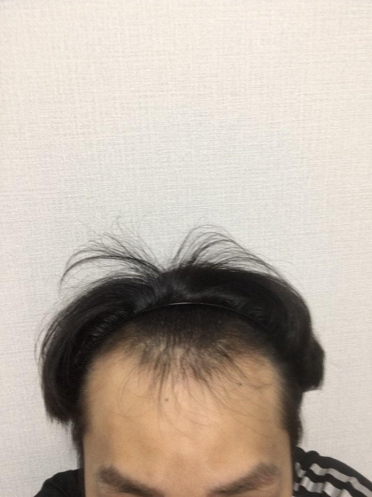 수술전.jpg