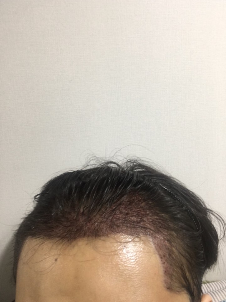7월31일.jpg