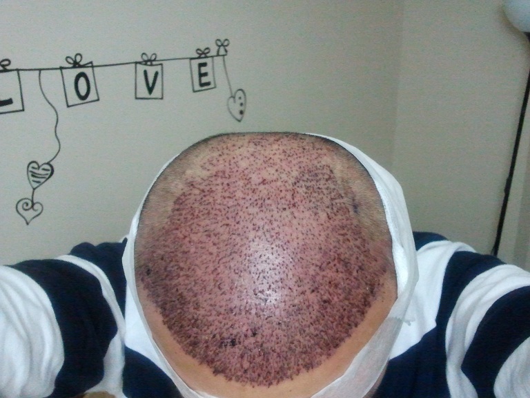 2011-10-05 19.23.46.jpg