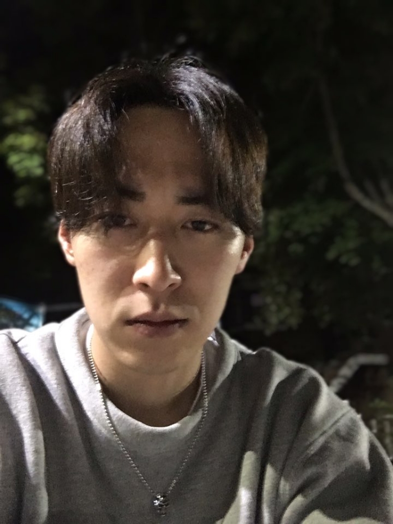 성공적인 모발이식 2년7개월경과(오랜만에 대다모들립니다)