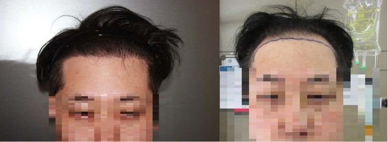 정면비교.jpg