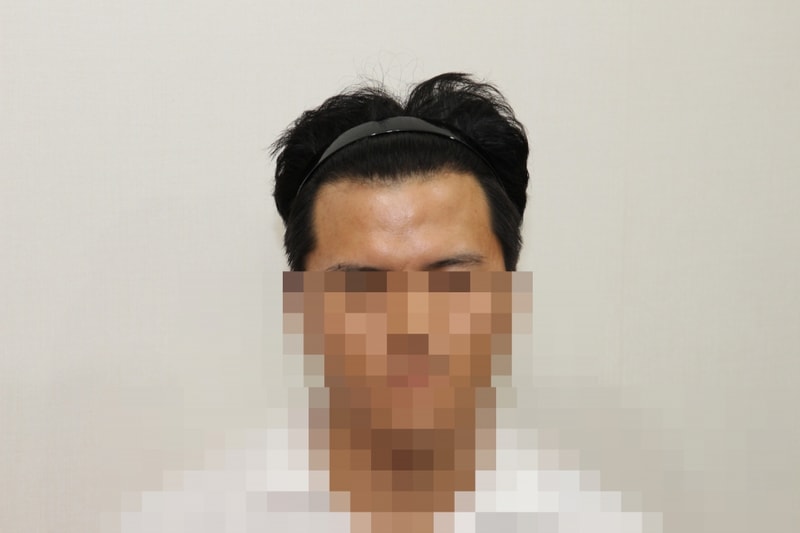 후1.JPG